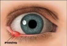 Ячмень: Сильные заговоры для себя, взрослым, детям дома. Кукиш