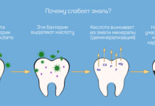 Как укрепить эмаль зубов: средства и рекомендации | Доктор Слон