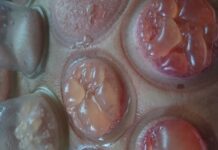 Герпес под банками — нужно ли его вытягивать? Здоровы с нами