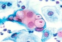 Герпес у беременных, лечение герпеса и профилактика в Турции