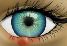 Можно ли греть ячмень, способы прогрева яйцом и синей лампой