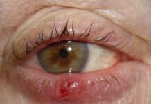 Можно ли греть ячмень — как это правильно делать