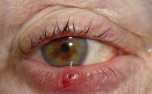 Можно ли греть ячмень — как это правильно делать