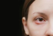 Отличия халязиона от ячменя