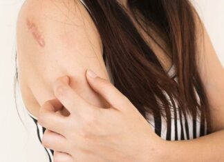 Лишай у человека — причины возникновения, симптомы, препараты и лекарства для лечения лишая