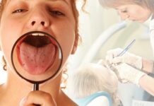 Что такое стоматит: откуда язвы на языке, небе, деснах – полезная информация, стоматология ЛидерСтом в Москве