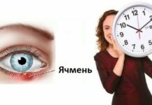 Как долго проходит внутренний ячмень. Причины появления и способы лечения ячменя на глазу. Когда обращаться к врачу