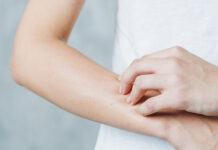 Кожная аллергия — причины, лечение аллергии на коже у детей и взрослых