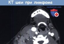 Причины, частота, диагностика и лечение новообразований шеи у детей