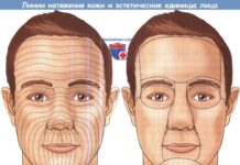 Методы лечения и коррекции рубцов на коже