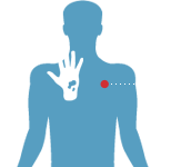 Симптомы и лечение экземы!