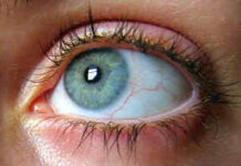 Плавающие мушки перед глазами — причины и лечение. Доступные цены, современная клиника в Москве.