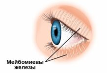 Мейбомит: причины, симптомы и лечение в статье офтальмолога-хирурга Цыганок С. А.