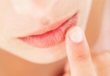 Опухла губа от герпеса: что делать если болит и как убрать?