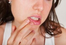 Герпес на губах сонник