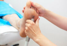 Пьезогенные папулы пяток и стоп: лечение и профилактика