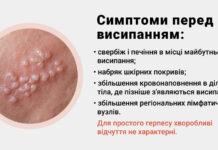 Герпетическая инфекция ~【Герпес】