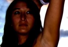 У кого, что есть в подмышках? Уплотнения, папилломы, темные пятна под мышками