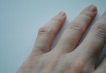 Шишка возле сустава пальца. — 18 ответов врачей на вопрос на сайте СпросиВрача