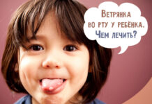 Ветрянка во рту у ребенка: чем обработать и чем лечить