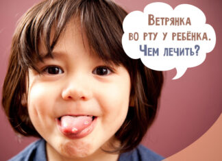 Ветрянка во рту у ребенка: чем обработать и чем лечить