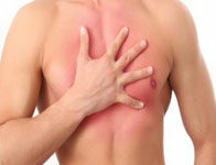 Герпетическая межреберная невралгия