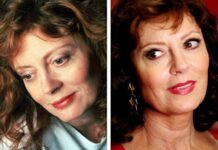 Как убрать обвисание щек эффективно: только проверенные советы