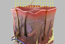 Как убрать пятна после экземы? | Методы лечения заболеваний