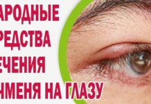 Народные средства от ячменя — как быстро избавиться от воспаления