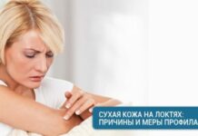 Сухая кожа на локтях: причины и меры профилактики