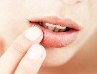 Что делать, если появился герпес после татуажа?