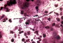 Инфекции во время беременности: анализы и лечение. Рекомендации гинеколога.