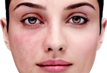 Причины раздражения кожи лица — Официальный сайт израильской косметики Christina в Украине