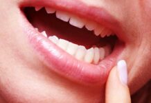 Почему во рту появляется стоматит – полезная информация, стоматология ЛидерСтом в Москве