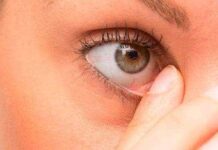 Ячмень на глазу при беременности — причины и чем лечить