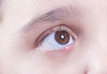 Ячмень чешется — что это значит