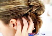 Замучил зуд кожи головы. Причины и методы лечения головного зуда