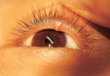 Как называется ячмень по научному: лечение