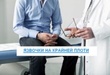 Язвочки на крайней плоти: причины, симптомы, лечение, осложнения