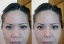 Эстетическое изменение внешнего вида