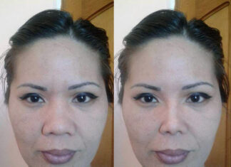 Эстетическое изменение внешнего вида