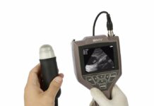 Сканеры ультразвуковой диагностики: общие характеристики