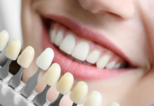 Металлокерамические коронки на Щёлковской