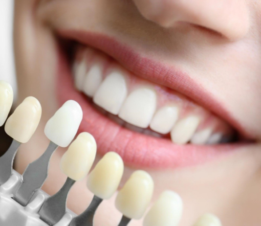 Металлокерамические коронки на Щёлковской