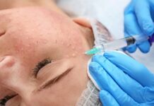 Зачем нужна биоревитализация лица