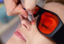 Обзор успешных косметических процедур с использованием лазера