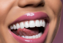 Зубные имплантаты: как они работают и когда они показаны