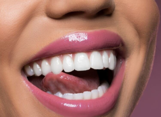 Зубные имплантаты: как они работают и когда они показаны