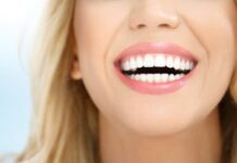 Почему важна красивая улыбка, и как ее добиться