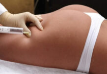 Липолитики P.I. для лица